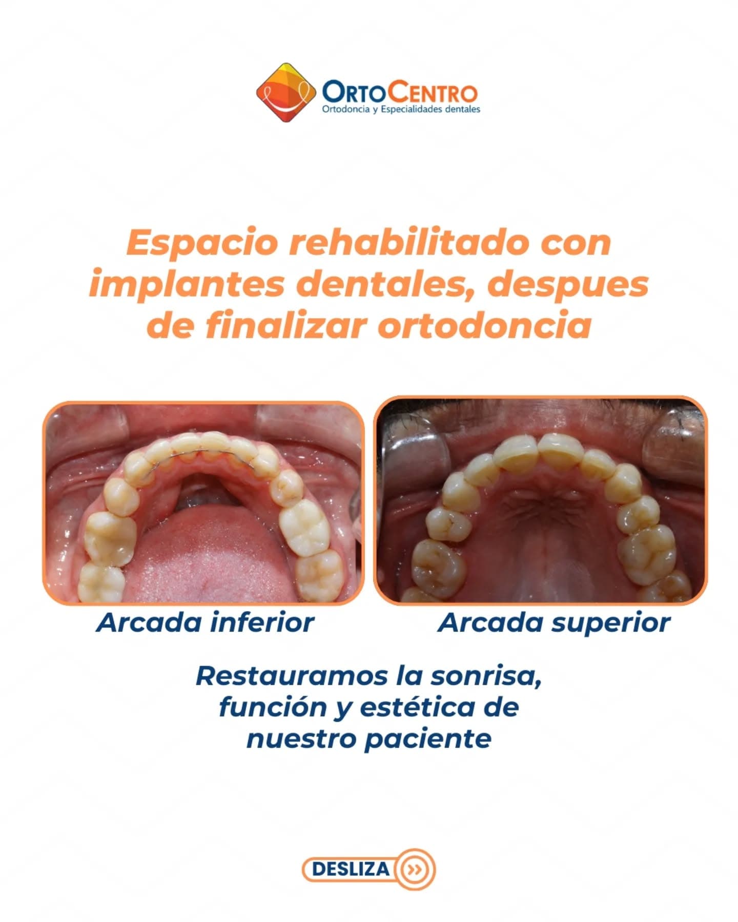 Arte real de OrtoCentro sobre rehabilitacion oral